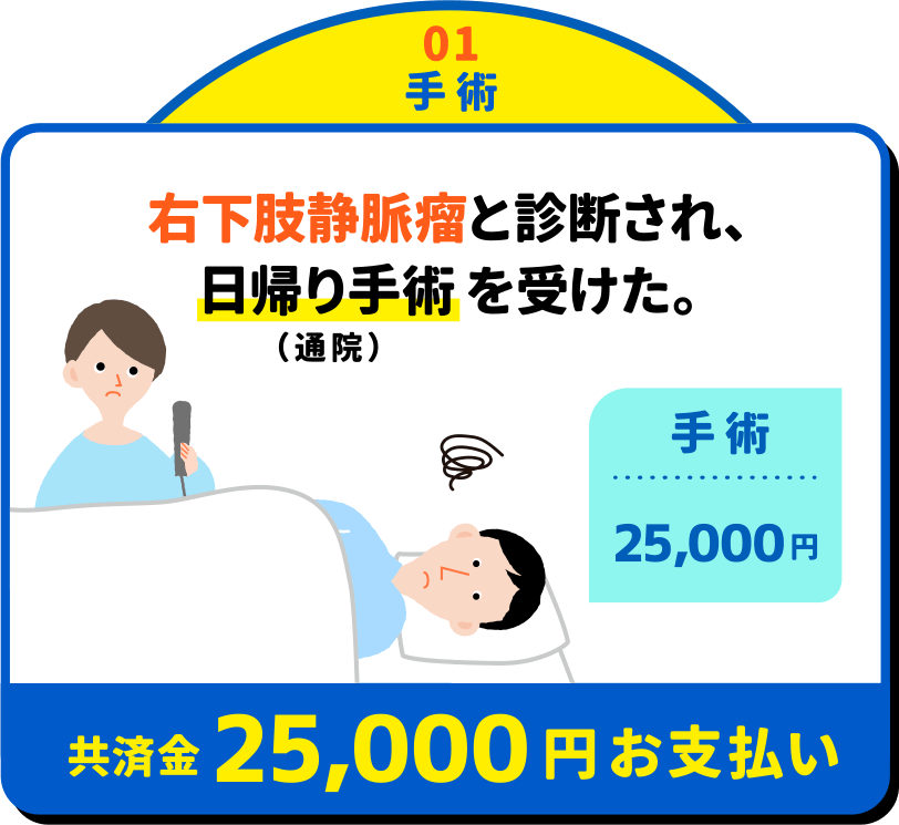 01手術：右下肢静脈瘤と診断され、日帰り手術（通院）を受けた。共済金25,000円お支払い